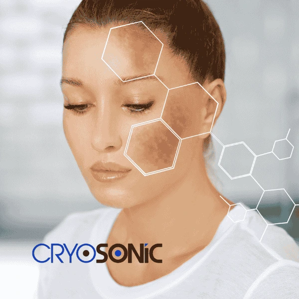 Are you looking for age spot removal treatment? Contact Cryosonic today in Chelmsford