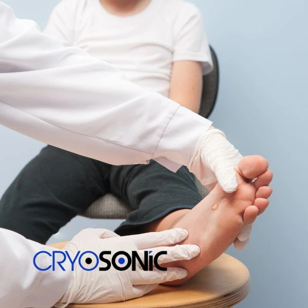 Are you looking for fast effective wart removal Contact us today Chelmsford